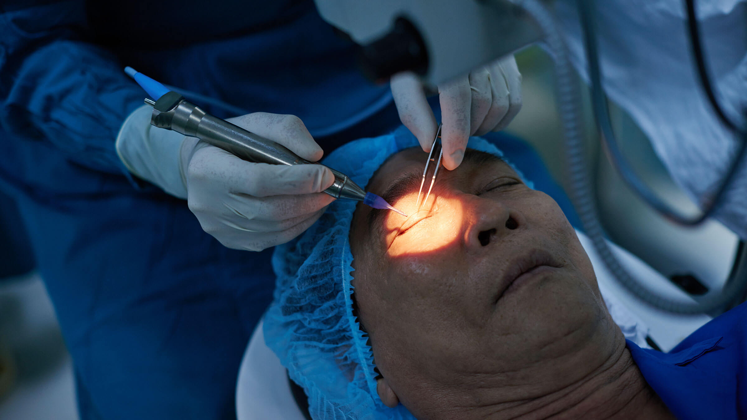 laser eye surgery